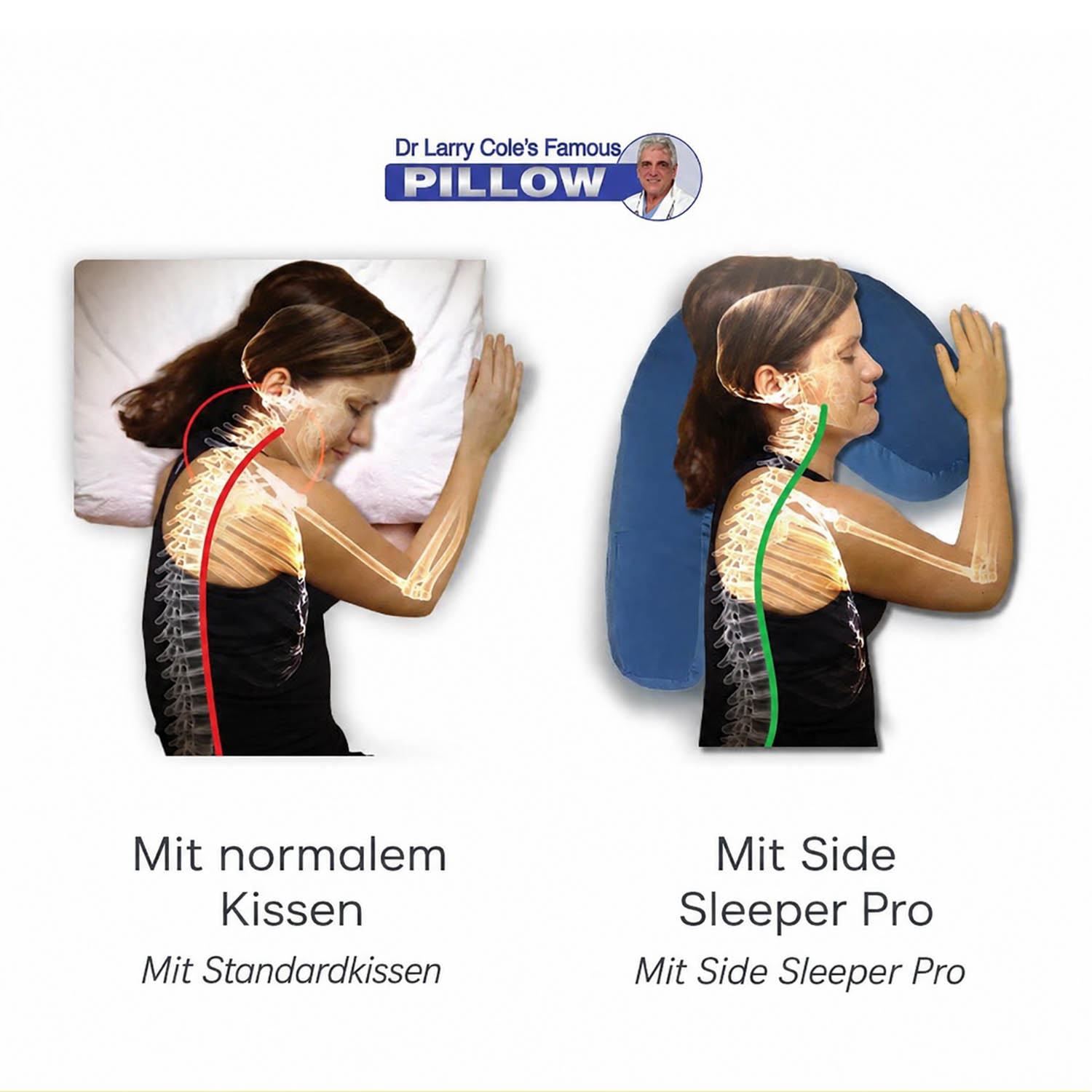Side Sleeper Pro – Seitenschläfer-Kissen: Nackenstütze, Anti-Schnarch, ergonomisch
